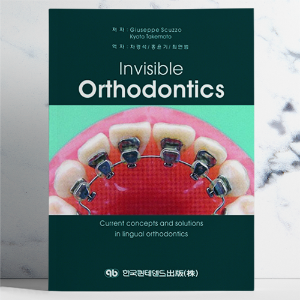 Invisible Orthodontics