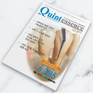 퀸테센스 2015년 6월호 - 1년 정기구독